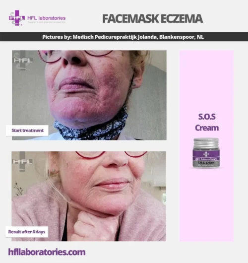 S.O.S. крем для раздраженной кожи