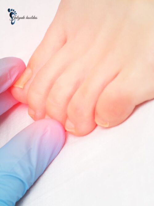 Toimumise aeg 18. november 2024 Koolituse kestus 10.00-14.00 Asukoht Pirni 71-36 Palume võimalusel leida endale kaasa modell, kelle peal saame praktika osa läbi viia. Kui see ei ole võimalik, leia 04.11 Koolitus: Sissekasvanud küüne hooldus ja ravi