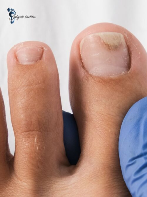 Untitled design (82) Koolitus: Onühholüüs - kuidas ära tunda?