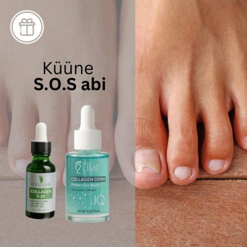 küüne s.o.s abi