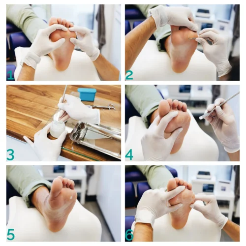 vercid preparaat soolatüügastele - 50 g