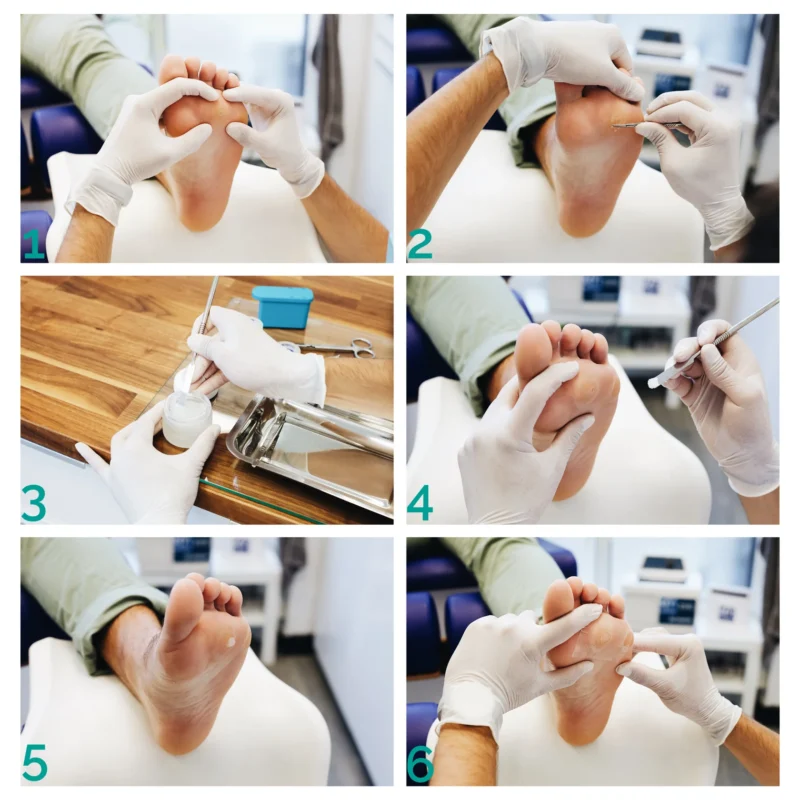 Vercid preparaat soolatüügastele - 50 g 2 vercid preparaat soolatüügastele - 50 g