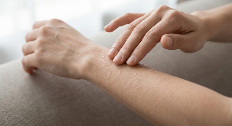 Glütseriin nahahoolduses: naha sügava niisutuse ja kaitse asendamatu nurgakivi